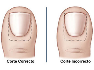 Foto: Campusnovella.com