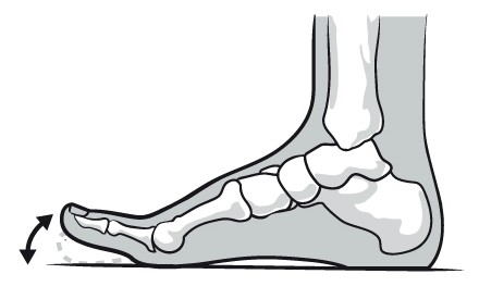 Hallux Rígidus